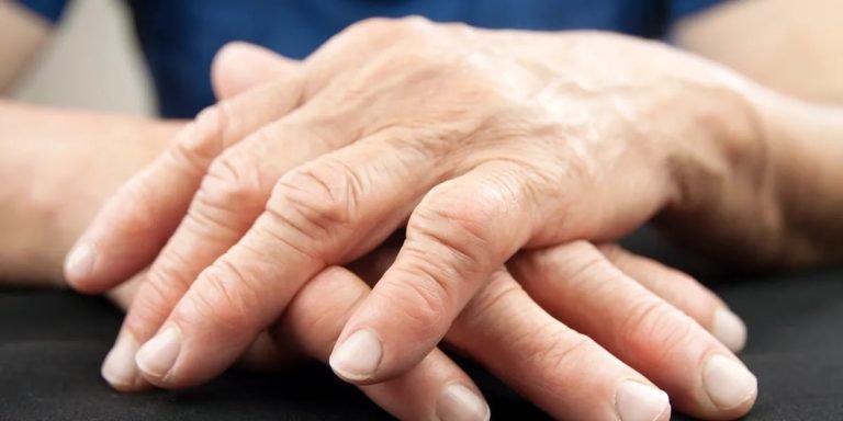 Close-up of an older adult's hands resting on a dark surface, with the finger joints and knuckles in focus